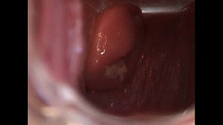 Ov Habri e Tonto ku Espéculo