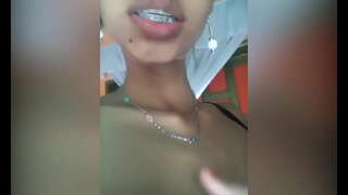 De Brand nou pizde umflate